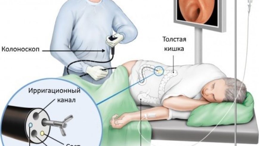 Колоноскопия во Владивостоке. Диагностика и лечение проктологических болезней