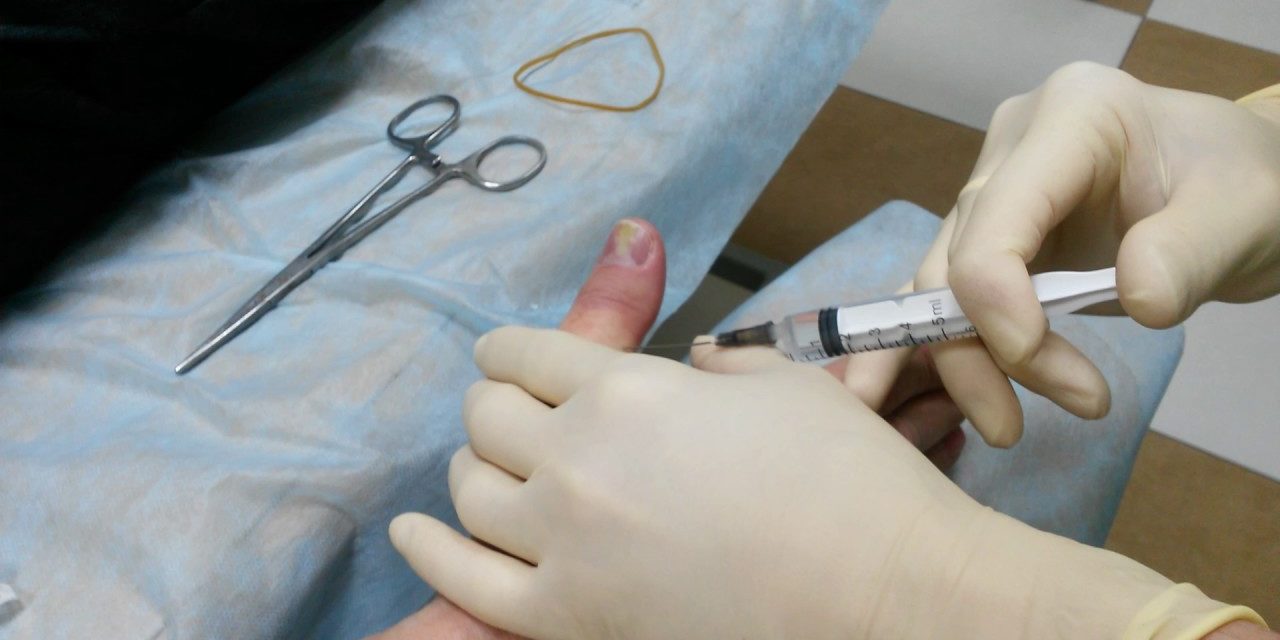 Амбулаторная хирургия при лечении панариция во Владивостоке 