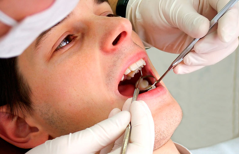 Лечение корневой кисты без удаления зуба в Клинике на Комарова